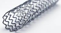 Govt slashes prices of coronary stents